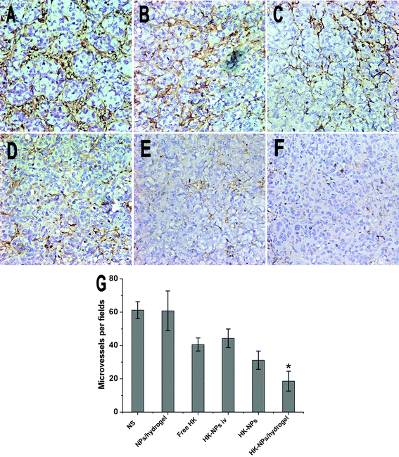 Inhibition of intratumoral angiogenesis assayed by CD34 staining of microvessels. Representative sections were taken from SKOV3 tumor tissue of NS (A), blank NPs/hydrogel (B), free HK (C), HK-NPs iv (D), HK-NPs (E), and HK-NPs/hydrogel (F) treated groups. The number of microvessels was significantly smaller in the HK-NPs-treated group compared with controls (P < 0.05), and in the HK-NPs/hydrogel-treated group a better anti-angiogenesis effect was observed (G).