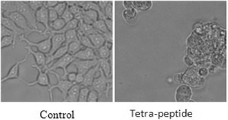 Phase contrast images showing cell death.