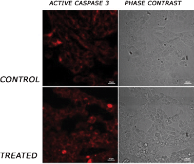 Active caspase 3 staining. HEK 293 cells were treated with the tetrapeptide overnight. The cells were fixed with 4% paraformaldehyde (PFA) and immunostained using a primary antibody against active caspase 3 and alexa-fluor 546 as the secondary antibody. The cells were imaged under a confocal microscope. First and second rows show control cells and cells treated with tetra-peptide. First and second columns show red staining for active caspase 3 and phase contrast micrographs of cells, respectively. Scale bar represents 20 μm.