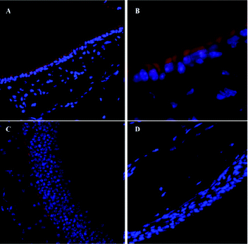 The distribution of Alexa647-labeled PPS NPs (red) in nasal tissue sections shows mucosal uptake: (A) ×20 and (B) ×63 magnification at 12 h post-administration; (C) ×20 magnification at 72 h post-administration; (D) ×20 magnification of untreated nasal tissue section. Reproduced from ref. 379 with permission from Elsevier.
