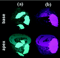 Elastomeric heart patches attached to the pericardium of rat hearts. Premature failure of a thermoplastic rubber patch (a), and maintenance of the physical integrity of a chemically cross-linked elastomer patch (b).