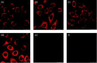 Fluorescence images of HeLa cells incubated with complex 26 (5 μM) at 37 °C for 1 h (a) before and (b) after subsequent fixation with MeOH, or (c) fixation with paraformaldehyde, followed by extensive washing with MeOH; (d)–(f): fluorescence images of HeLa cells treated and fixed with the same procedures, except that [Ir(pq)2(Ph2-phen)](PF6) was used as the staining reagent. Taken from ref. 43.