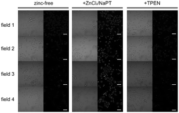 Microscopy images of live A549 cells incubated with complex 34b (5 μM, 30 min; left columns), then with ZnCl2/NaPT (1 : 1, v/v, 50 μM, 15 min; middle columns), and finally with TPEN (100 μM, 15 min; right columns). Left panels, bright-field images; right panels, phosphorescence images. Scale bar corresponds to 50 μm. Identical intensity scales have been applied. Images were acquired from four independent experiments (fields 1–4). Taken from ref. 53.