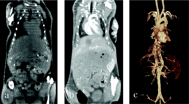 Micro CT images: precontrast (a), contrast enhanced at 6 h after AuNP–PEG injection (b), and 3D-volume rendered images (c). The major vessels are well visualized throughout the mouse and the smaller branches can also be traced.87