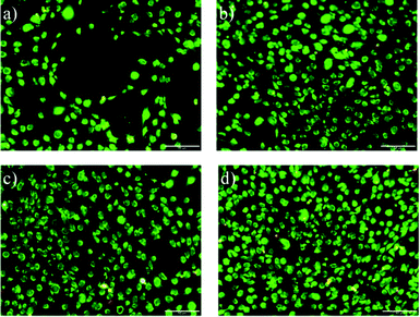 LIVE/DEAD staining of MC-3T3-E1 osteoblasts a) PVDF non-poled and b) PVDF non-poled with titanium; c) PVDF poled + and d) PVDF poled + with titanium after cell culture for 3 days. The scale bar is 50 μm for all the images.
