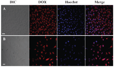 CLSM images of Hela cells (A) incubated with DOX-loaded PHEMA-g-(PCL-A:U-PEG) micelles for 30 min; (B) incubated with free DOX for 30 min. Cell nuclei were stained with Hoechst 33342; scale bars correspond to 30 μm in all images.