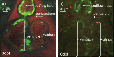 (a) Confocal images of zebrafish heart immediately after injection of fluorescent PEOSN (b) and the same injected larvae imaged 3 days later.