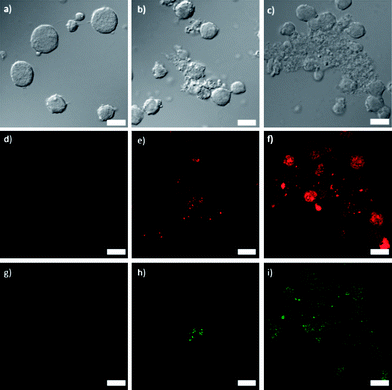 (a–c) Differential interference contrast (DIC) images and (d–i) fluorescence images of Jurkat cells incubated with 3a (d, g), 3b (e, h), and 3c (f, i). Red fluorescence (d–f) is from the Ru(bpy)32+-doped particles and green fluorescence (g–i) is from the Annexin V FITC conjugate early apoptosis stain. Scale bars represent 25 μm.