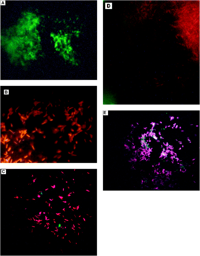 Fluorescence microscopic images of (A): untreated (control) cells showing no damage (green); (B, C): Treated cells under light conditions showing the presence of damaged (bright red) as well as undamaged cells (green); (D, E): Cells treated under dark conditions showing the presence of damaged (bright red), undamaged cells (green) and injured cells (orange red).