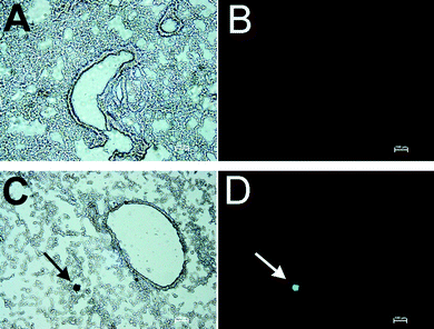 Double staining for AChE activity and TUNEL assay. Mice treated with 1500 mg kg−1 TOCP and control mice were sacrificed at 4 days post dosing. A: Section of inflated lung from control mouse stained for AChE activity; dark brown areas are positive for AChE activity. B: The section in A counterstained for fragmentation of genomic DNA with the TUNEL assay shows no fluorescent cells. C: Section of inflated lung from a TOCP treated mouse stained for AChE activity; the arrow points to a cell that stains heavily for AChE activity. D: The section in C counterstained for fragmentation of genomic DNA with the TUNEL assay; the arrow points to the green fluorescent cell that is positive for genomic DNA fragmentation. Scale bar, 100 μm.