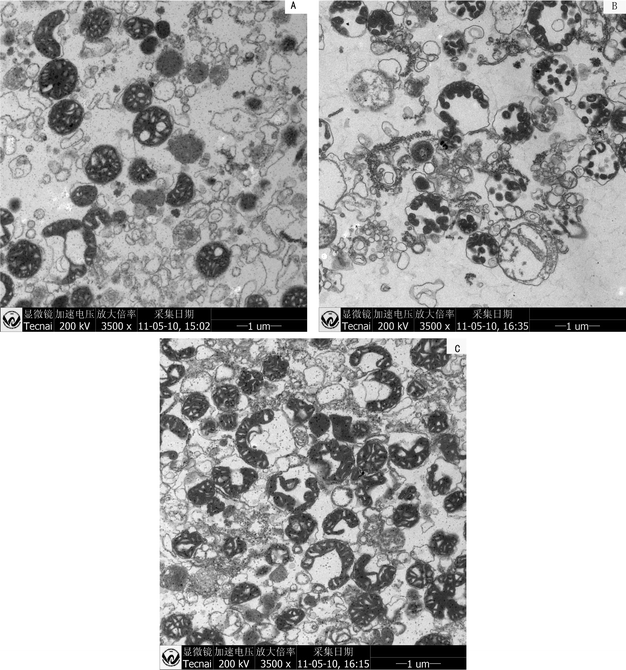 Effects of ZnO NPs on mitochondrial ultrastructure. Mitochondria were incubated in the standard medium with 0 (A), 5 (B) or 50 (C) μg ml−1 ZnO NPs.