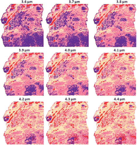False colour classification images of the 5 class histological model for prostate tissue. Classifier trained on a database of transflection simulated spectra of 4 μm thickness using a first derivative.
