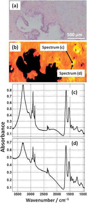 (a) H&E micrograph from a prostate tissue section. (b) False colour heat-map of the Amide I intensity of FTIR image of the serial section of tissue (a). (c) and (d) show two raw spectra (no pre-processing) that are located approximately 20 μm from each other.