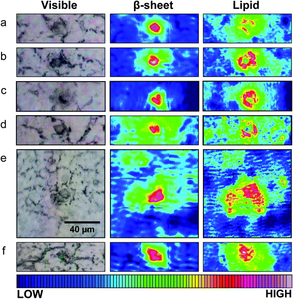 Typical visible and FTIR images of unstained tissue containing dense core plaque observed in three different CRND8 mice aged 5 months (a–d) and two aged 8 months (e and f). Left column: dense core appears darker than surrounding tissue under white light. Central column: aggregated plaque is shown from intensity of β-sheet shoulder. Right column: plaques are surrounded by lipid membrane-like signature that infiltrates to the core of all plaques, at this spatial resolution. Scale bar = 40 µm and applies to all images. Colour bar indicates low (blue) to high (red) for component imaged.