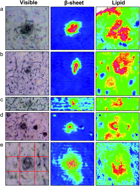 Typical visible and FTIR images of dense core plaque observed in five different 3×Tg mice aged (a) 12 months (b–d) 15 months and (e) 17 months. Left column: dense core appears darker than surrounding unstained tissue under white light. Central column: aggregated plaque is shown from intensity of β-sheet shoulder. Right column: plaques are surrounded by lipid membrane-like signature that infiltrates to the core of all plaques, at this spatial resolution. Red lines in (e) denote the 3 × 3 tiles of the mosaic. Tile = 64 × 64 pixels = 34.5 × 34.5 µm2. Colour scale as in Fig. 2.