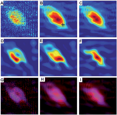 Effect of spectral pre-processing on deconvoluted chemical images of the localization of 1 (A1 mode). The top (A–C) row indicates original data with or without pre-processing. The middle row (D–F) shows the results of deconvolution on the corresponding datasets in the top row. The bottom row (G–I) shows red/blue overlays of the previous two rows to demonstrate the impact of deconvolution; original data is displayed as red and deconvoluted data as blue. The columns are aligned such that the left column (A, D, and G) has no spectral pre-processing, the middle column (B, E, and H) has been treated with PCA noise-reduction, and the right column (C, F, and I) has been treated with PCA noise-reduction followed by RMie scatter-correction.