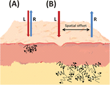 Simplified graphical representation of (A) spontaneous Raman compared to (B) spatially offset Raman scattering, illustrating the spatial offset and deeper subsurface probing in skin tissue. L = laser light, R = Raman light.