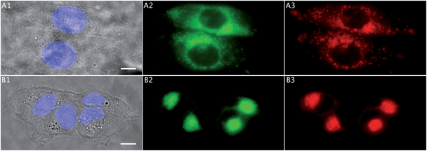 Colocalization studies (Sections 3.5 and 3.6). (A) Two MCF-7 breast cancer cells incubated with 1 (25 μM, 1 h): (A1) bright field image (scale bar: 10 μm) and the nucleus stained with DAPI (blue), (A2) 1 in green, (A3) Golgi tracker in red. (B) Four MDA-MB-231 breast cancer cells incubated with 1 (25 μM, 1 h): (B1) bright field image (scale bar: 10 μm) and the nucleus stained with DAPI (blue), (B2) 1 in green, (B3) Golgi tracker in red. All cells were fixed and slides were mounted.