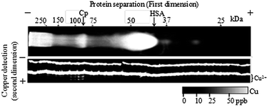 Typical copper ion mapping using MICS-BN-PAGE/copper detection PAGE for human serum (a healthy female, age 25) at low temperature (0 °C on the gel surface, −5 °C in the incubator).