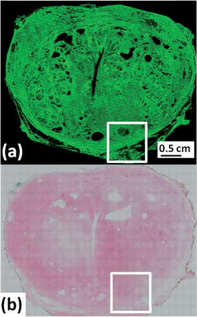 Whole prostate cross section (a) 66 million pixel chemical image of absorbance at 1655 cm−1 (amide I). (b) H&E micrograph of serial section to (a).