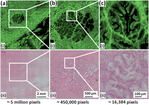 Expanded regions of chemical image and H&E micrograph from Fig. 1. (a) Expansion of white square in Fig. 1. (b) Expansion of region highlighted in (a). (c) Expansion of region highlighted in (b) corresponding to a single 128 × 128 tile comprising 16 384 spectra.