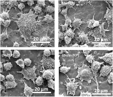 FE-SEM micrographs illustrating the RAW 264.7 cell morphologies after 5 days of culture with RANKL.
