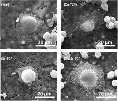 FE-SEM micrographs illustrating osteoclast-like-cell morphologies after 8 days of culture with RANKL.