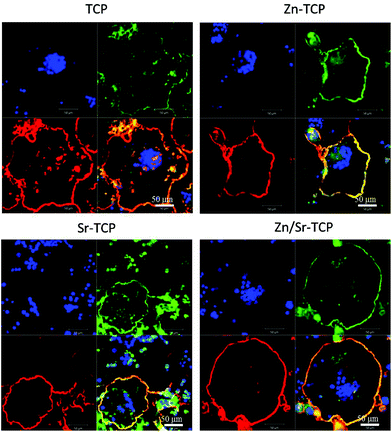 Fluorescence microscopy images of cells cultured for 14 days. The red represents the actin cytoskeleton, green indicates vitronectin receptor αvβ3 integrin and blue represents the nucleolus.