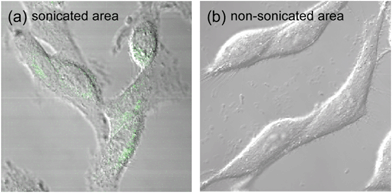 Confirmation of 1O2 generation by sonication of HeLa cells treated with PIC micelles. Confocal laser scanning microscopic image overlaid with the differential interference contrast image of HeLa cells treated with a mixture of 2k13 micelles and SOSG for 4 hours, and then sonicated for 5 min at a frequency of 1.0 MHz, a power of 0.5 W cm−2 and a duty cycle of 10%.