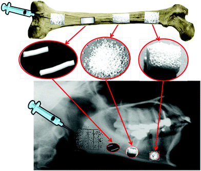 Different uses of calcium phosphate bioceramics.