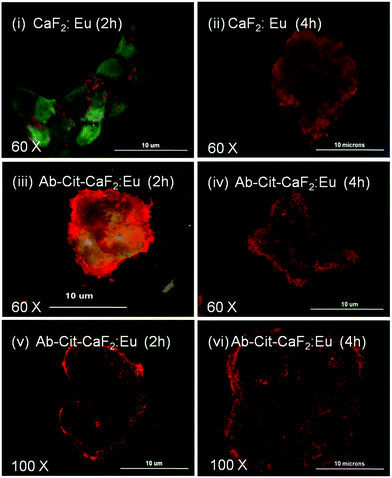 Fluorescent microscopic images showing the interaction of bare CaF2:Eu and antibody conjugated Cit-CaF2:Eu nanoparticles (Ab-Cit-CaF2:Eu) with EGFR over-expressing, human epidermoid carcinoma A431 cells for 2 and 4 hours of incubation, observed at different magnifications.