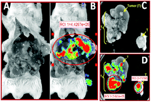 
            Ex vivo bioluminescence from luciferase expression after administration of 3.3 mol% PR_b, 5 mol% PEG2000 functionalized stealth liposomes in the CT26 tumor bearing mouse 12 shown in Fig. 5. Total relative optical intensity (ROI) as measured in photons/second/cm2 by the Xenogen IVIS Imaging System is shown for each image lateral dissection showing tumor load on liver (A) with superimposed bioluminescence (B). Excised liver showing white tumor nodules (C) with superimposed bioluminescence (D).