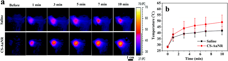 (a) Infrared thermal images of the tumor in tumor bearing mice at different NIR laser irradiation times. The irradiation was performed at 8 h following IV injection of saline or CS-AuNR NSs; (b) average temperature of the entire tumor region according to the infrared thermal images.