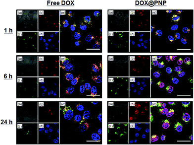 Confocal fluorescence microscopy images of KB-C-2 cells incubated with free DOX (left) and DOX@PNP (right). (a) Bright field, (b) DOX, (c) Lysotracker Green DND26, (d) Hoechst 33342, and (e) a merged image. DOX concentration = 10 μg mL−1. Scale bar = 20 μm.