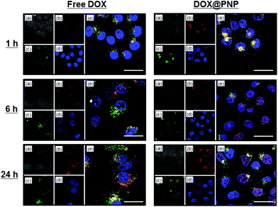 Confocal fluorescence microscopy images of KB/MRP cells incubated with free DOX (left) and DOX@PNP (right). (a) Bright field, (b) DOX, (c) Lysotracker Green DND26, (d) Hoechst 33342, and (e) a merged image. DOX concentration = 10 μg mL−1. Scale bar = 20 μm.