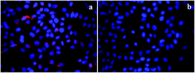 Intracellular uptake of HeLa cells incubated with 5 μg ml−1 of RITC-FA-HSNPs (a) in the absence of free FA in the medium and (b) in the presence of excess free FA in the medium.