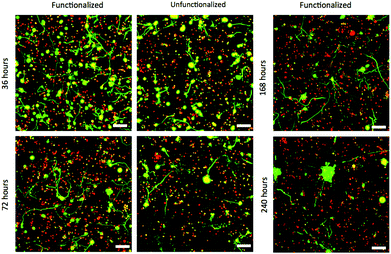 Confocal Z-stacks Live (green)/Dead (red) stain of dissociated ESMNs in functionalized and unfunctionalized hydrogels at different time points. The unfunctionalized gels were not imaged after 168 hours. By 240 hours, all live cells existed in multicellular aggregates (scale bar 100 μm).