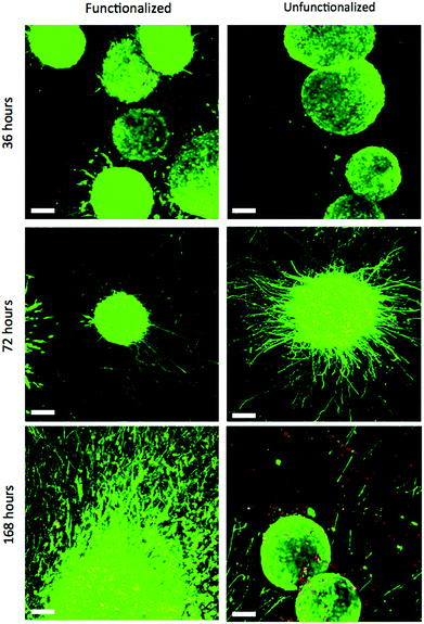 Confocal Z-stacks Live (green)/Dead (red) stain of encapsulated EBs in functionalized and unfunctionalized gels at different time points. The image of the EBs in the unfunctionalized gel after 168 hours is not representative, but shows that a subset of EBs failed to extend axons (scale bar 100 μm).