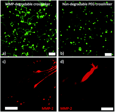(a) Z-projection of motor neurons cultured for 36 hours in gel with MMP-degradable peptide crosslinker (scale bar 100 μm). (b) Z-projection of motor neurons cultured for 36 hours in gel with non-degradable PEG crosslinker. Motor neurons axon extension is limited (scale bar 100 μm). (c) MMP-2 immunostaining showing MMP-2 in growth cone of multiple axons. The cells bodies are contained in an embryoid body to the right of the frame (scale bar 50 μm). (d) Higher magnification image of one growth cone showing MMP-2 staining (scale bar 10 μm).