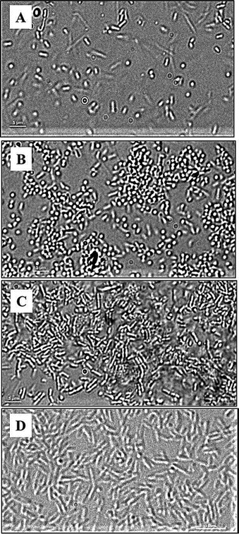DIC images of P. aeruginosa PAO1 (A, B, C) and P. aeruginosa PAO1 ΔpilAΔfliC double mutant (D) at the surface of glass (A), SPM (B and D), and METAC (C); P. aeruginosa PAO1 bacteria associated with SPM (B) are seen as “dots” as they are perpendicularly oriented with respect to the SPM brush surface. This is not seen in P. aeruginosa PAO1 associated with METAC or in the P. aeruginosa PAO1 ΔpilAΔfliC double mutant on SPM. Note that cells of the double mutant have a larger size than the wild type, are non-motile, and did not come in contact with the SPM surface (making focusing difficult and giving rise to the less sharp image in D).
