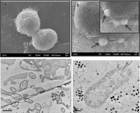 SEM images of MCF-7 (a) and MCF-7 cells exposed to 50 μg ml−1 of 25 nm IONPs that were exposed to RF (350 kHz) for 20 minutes; arrows point to the outward evagination of cell plasma membrane (b); the inset is an enlarged image showing plasma membrane blebs. (c) TEM image showing cell destruction, fragmentation, and (d) mitochondrial damage after being exposed to RF.