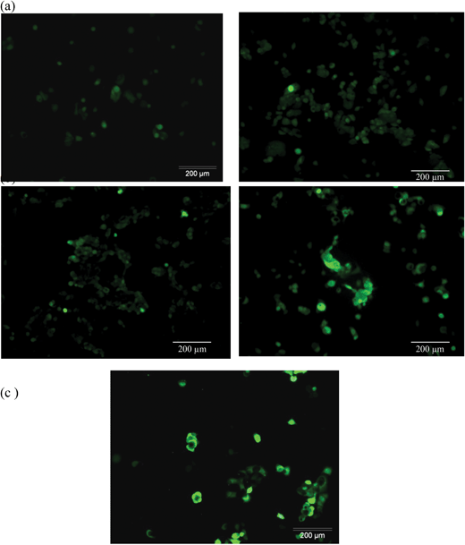 ROS-H2DCFDDA assay for intracellular reactive oxygen species with IONPs with (right column) and without (left column) RF treatment. (a) The control and (b) at a concentration of 50 μg ml−1. (c) H2O2 (100 μM) as the positive control.