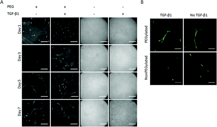 Light micrograph images of hMSCs cultured in various gel conditions. Network formation and growth is evident in PEGylated fibrin gels with and without 100 ng ml−1 TGF-β1. Scale bar represents 200 μm. Fluorescent images of calcein-AM stained hMSCs within gels at day 7 (B). HMSCs demonstrated network formation in PEGylated gels and were not inhibited by 100 ng ml−1 TGF-β1. Scale bar represents 150 μm.
