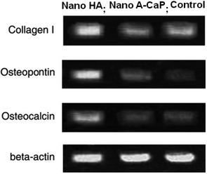 The crystallinity of CaP affects the cellular response. Agarose electrophoresis gels showing relative collagen I, osteopontin, osteocalcin and beta-actin expression levels studied by RT-PCR. The cells were seeded onto the films at a density of 6 × 103 cm2 and cultured for two weeks. The substrates of CaP have similar sizes ∼20 nm.26,96