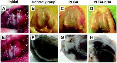 Photographs of rat articular cartilage defects after immediate creation (A) and after treatment with scaffolds (E). Gross appearance of the repaired cartilage at 12 weeks post-operation in the control group (B and F), pure PLGA group (C and G) and PLGA/HA nanoparticle group (D and H). Images (B–D) were front views and images (F–H) were cross-section views.120