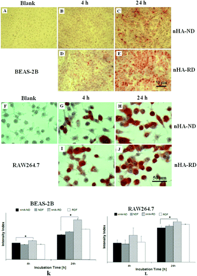 Images (A–E) are Alizarin red S stained BEAS-2B cells cultured in different conditions. Images (F–J) are Alizarin red S stained RAW264.7 cells cultured in different conditions. Graphs (K and L) are the quantifications of Alizarin red S staining of BEAS-2B (K) and RAW264.7 (I), cells were cultured in 100 μg mL−1 of nanocrystalline HA over 4 h and 24 h.52