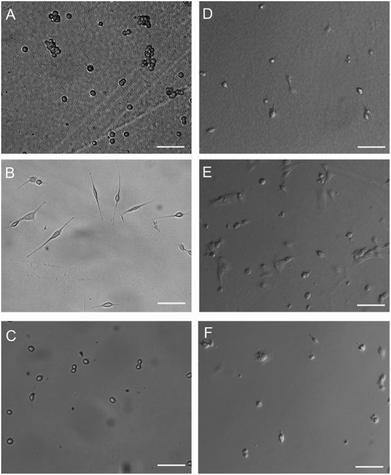 A–C: BALB/3T3 mouse fibroblasts cultured on films made of eADF4(C16) (A), ntagCysC16-c(RGDfK) (B) or N[AS]8C (C) with a cell seeding density of 5000 cells per cm2 after 24 hours of incubation. D–F: C2C12 myoblasts cultured on films made of eADF4(C16) (D), ntagCysC16-c(RGDfK) (E) or N[AS]8C (F) with a cell seeding density of 5000 cells per cm2 after 24 hours of incubation. Scale bars: 100 μm.