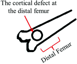 Schematic of the rat distal femoral cortical defect model (anterior view).