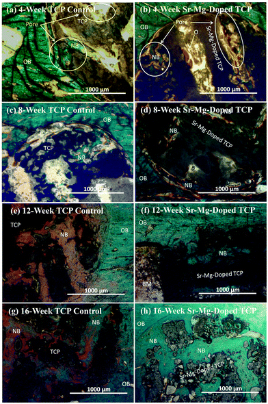 Photomicrograph of 3DP pure TCP implants (a, c, e and g), and Sr/Mg doped TCP implants (b, d, f and h) showing the development of new bone formation and bone remodeling inside the interconnected macro and intrinsic micro pores of the 3DP scaffolds after 4, 8, 12 and 16 weeks in rat distal femur model. Modified Masson Goldner's trichrome staining of transverse section. OB: old bone, NB: new bone, O: osteoid, and BM: bone marrow. Color description: dark grey/black = scaffold; orange/red = osteoid; green/bluish = new mineralized bone (NMB)/old bone.