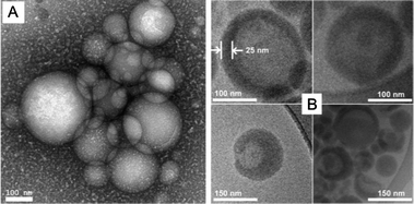 TEM images with negative staining (A) and cryo-TEM images with positive staining (B) for cross-linked polymer vesicle from P(ONB-diacid)25-b-P(ONB-PEG2K)5 (CPV25).